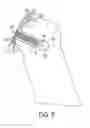 Fig. 06 - Surgical screw and method of performing ligament reconstruction using said screw