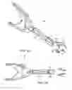 Fig. 04 - ARTHROPLASTY REVISION DEVICE AND METHOD