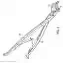 Fig. 08 - ARTHROPLASTY REVISION DEVICE AND METHOD