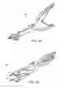 Fig. 09 - ARTHROPLASTY REVISION DEVICE AND METHOD