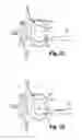 Fig. 14 - Method and apparatus for delivering an intervertebral disc implant