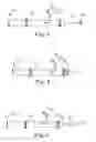 Fig. 03 - Integrated lead for applying cardiac resynchronization therapy and neural stimulation therapy