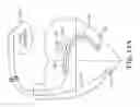 Fig. 06 - Integrated lead for applying cardiac resynchronization therapy and neural stimulation therapy