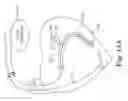 Fig. 08 - Integrated lead for applying cardiac resynchronization therapy and neural stimulation therapy