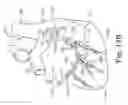 Fig. 09 - Integrated lead for applying cardiac resynchronization therapy and neural stimulation therapy