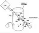Fig. 01 - Dorsal column stimulation therapy