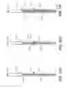 Fig. 04 - Low Profile Prosthesis