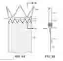 Fig. 07 - Low Profile Prosthesis