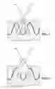Fig. 09 - Low Profile Prosthesis