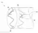 Fig. 01 - Medical device and method of manufacturing same