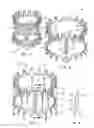Fig. 03 - Minimally invasive heart valve replacement