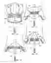Fig. 05 - Minimally invasive heart valve replacement