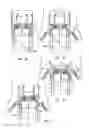 Fig. 09 - Minimally invasive heart valve replacement