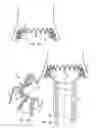 Fig. 10 - Minimally invasive heart valve replacement
