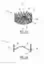 Fig. 06 - Implantable prosthetic valve for treating aortic stenosis