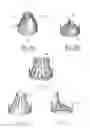 Fig. 11 - Implantable prosthetic valve for treating aortic stenosis