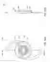 Fig. 37 - Masked intraocular implants and lenses