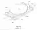Fig. 22 - Intraocular lens system