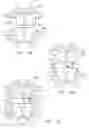 Fig. 06 - Posterior spinal implant system