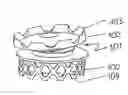 Fig. 01 - Space keeper for vertebrae or intervertebral disks