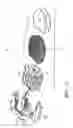 Fig. 07 - Prosthetic intervertebral discs having substantially rigid end plates, fibers between those end plates, and core members with comparatively thin edges