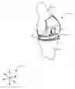 Fig. 01 - Systems and methods for mobile bearing prosthetic knee