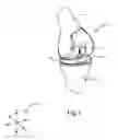 Fig. 02 - Systems and methods for mobile bearing prosthetic knee