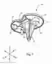 Fig. 08 - Systems and methods for mobile bearing prosthetic knee