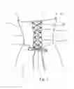 Fig. 04 - Garment