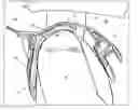 Fig. 01 - Protecting device for the neck