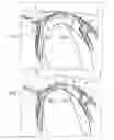 Fig. 02 - Protecting device for the neck