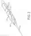 Fig. 03 - INTERDENTAL BRUSH