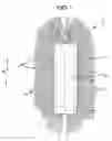 Fig. 02 - CLEANING ARTICLE