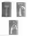Fig. 02 - Dual headed razor blade system