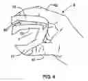 Fig. 05 - Food handling device