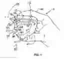 Fig. 12 - Food handling device