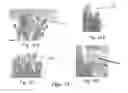 Fig. 09 - Convex Cutting and Trimming Method for Shaping Trees
