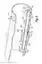 Fig. 04 - COOLER DISTRIBUTOR FOR A HEAT EXCHANGER
