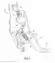 Fig. 02 - BRAKE PEDAL ASSEMBLY HAVING NON-CONTACTING SENSOR