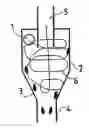 Fig. 01 - Cyclone separator device for gas-oil separation