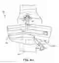 Fig. 14 - Universal C arm tape drape