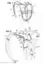 Fig. 02 - Prop-supporting harness for a stage performer