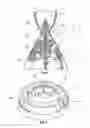 Fig. 02 - Robust capacitive distance sensor