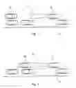 Fig. 02 - Method for operating a driver assistance system when parking a vehicle in a parking space