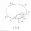 Fig. 06 - SEAMLESS BIFOCAL LENS
