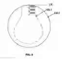 Fig. 08 - Multiple layer multifocal composite lens