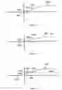 Fig. 16 - Multifocal lens having a progressive optical power region and a discontinuity