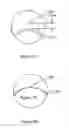 Fig. 19 - Multifocal lens having a progressive optical power region and a discontinuity