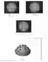 Fig. 03 - Method and apparatus for determining reflectance data of a subject