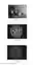 Fig. 04 - Method and apparatus for determining reflectance data of a subject